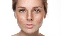 Skin Renewal Pigmentation Newsletter